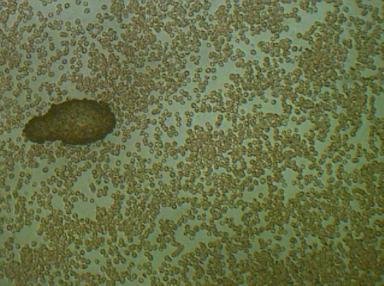 Ta sama blacha w powiększeniu 160x