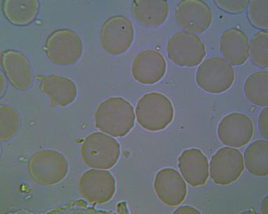 Stan narządów wewnętrznych